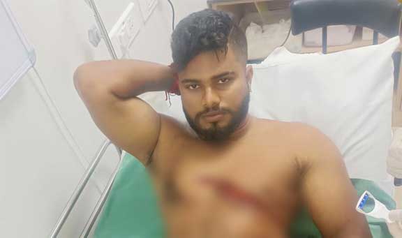 Personal enmity – Youth stabbed  his friend near Farangipete